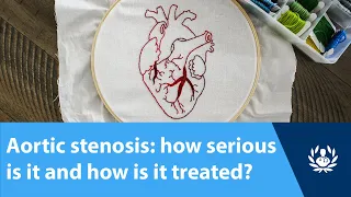 Aortic stenosis: how serious is it and how is it treated?