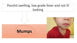 Infectious Diseases -Board Review II