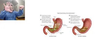 Digestive System 5 Gastric emptying