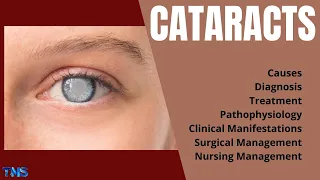 CATARACTS | Risk Factors | Pathophysiology | Nursing Management | Treatment || The Nurses Station