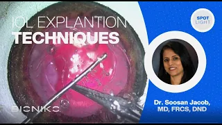 BIONIKO | Surgeon Spotlight - Dr. Soosan Jacob | IOL EXPLANT Scenarios with OKULO BR8