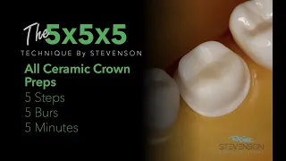 All Ceramic Crown Prep in 5 Minutes| The 5x5x5 Technique