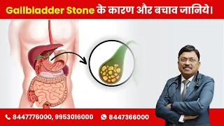 Gallstones Causes and Prevention | Gallbladder Stone के कारण और बचाव जानिये |Dr Bimal Chhajer |SAAOL