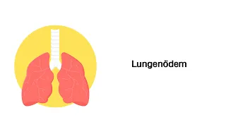 Lungenödem - Erkrankungen der Atemwege