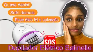 QUASE ARRANQUEI O QUE NÃO DEVIA. MINHA EXPERIÊNCIA COM O DEPILADOR PHILIPS SATINELLE.