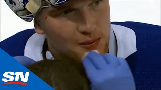 Andrei Vasilevskiy Left Bloody After Taking Knee To The Head On Diving Save