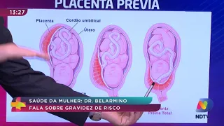 Saúde da Mulher: Dr. Belarmino fala sobre gravidez de risco