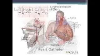 The Lung Transplant Evaluation Process at Tampa General