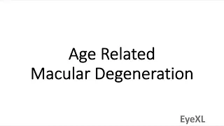 Age Related Macular Degeneration