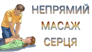 Непрямий масаж серця. Ефективні сучасні апарати.