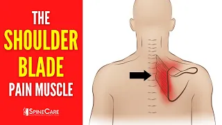 The Shoulder Blade Pain Muscle (How to Release It for INSTANT RELIEF)