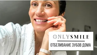 ОТБЕЛИВАНИЕ ЗУБОВ ДОМА | ONLYSMILE