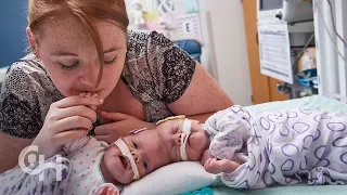 Conjoined Twins Abby and Erin Delaney: A Year in the Life