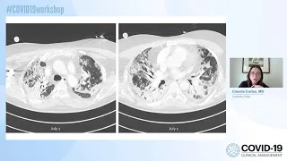 COVID-19 Clinical Management Workshop | COVID-19 Clinical Case | Claudia Cortes
