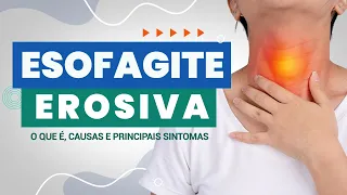 Esofagite Erosiva: O que é, causas e principais sintomas