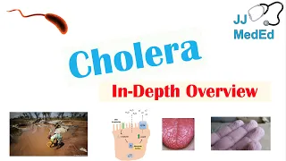 Cholera (Vibrio Cholerae) Pathophysiology, Risk Factors, Symptoms, Diagnosis, and Treatment