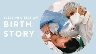 My Elective C-Section Birth Story | Susan Yara