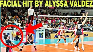 ALYSSA VALDEZ ALMOST FACIAL HIT TO NABOR! #Alyssavaldez #volleyball #volleyballplayer