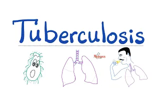 Tuberculosis (TB) [formerly Phthisis Pulmonalis] | Respiratory Pathology