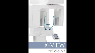 X View Trident - Installation