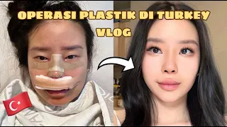 OPERASI PLASTIK DI TURKEY?! | Rhinoplasty Plastic Surgery Vlog | Bahasa Indonesia