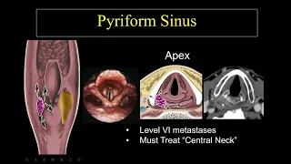 Suresh Mukherji  Imaging of the Hypopharynx