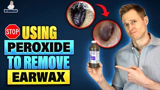 Stop Using Hydrogen Peroxide to remove Earwax!