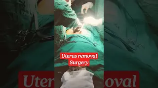 बच्चेदानी का ऑपरेशन कैसे होता है?,uterus removal surgery|| #medicos #doctor #medicalstatus #shorts