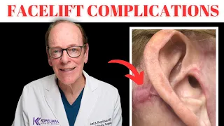 How to Manage Facelift Complications | Plastic Surgeon Advice