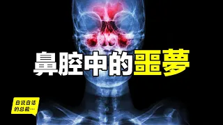 When You Got Rhinitis, That’s What Happens Inside Your Body...丨The Self-Talking Boss