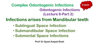 Sublingual Space Infection | Submandibular Space Infection | Submental Space Infection