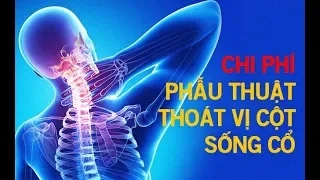 Chi phí phẫu thuật thoát vị cột sống cổ?