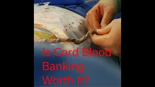 Cord Blood Banking-Should I do it? Is it worth it?