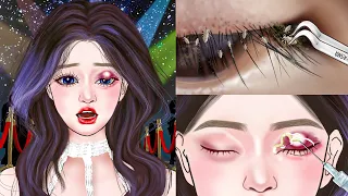 ASMR Eyelid Big Acne Extrusion & Lashes Lice Removal - Dirty Lashes Deep Cleaning Animation