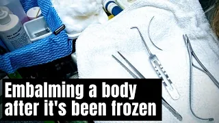 In the mortuary - Embalming a frozen body