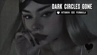 get rid of dark circles // subliminal