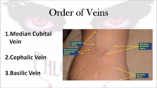 Phlebotomy: The Order of Veins