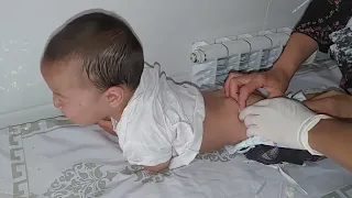 Injection Into The Baby's Buttock. IM INJECTION . Внутримышечный укол детям в ягодицу