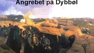 Slaget ved Dybbøl