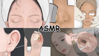 Pimple popping, Ear Wax, Ingrown toenail / Super Satisfying ASMR Compilation! LULUPANG Anime