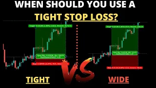 Should You Use a Tight Stop Loss?