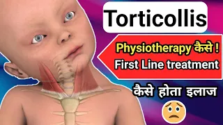 torticollis | torticollis treatment | torticollis in hindi | torticollis brace #torticollis