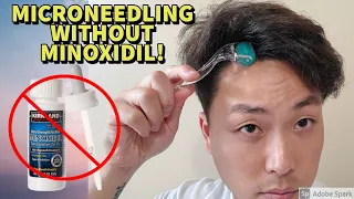 Microneedling WITHOUT Minoxidil For Treating Hair Loss! Is Hair Growth Possible?