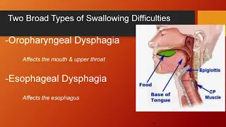 When Myositis leads to dysphagia, Dr  Endashaw Omer