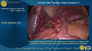 Laparoscopic Longitudinal Pancreaticojejunostomy (Puestow)...