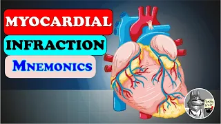 Mnemonic For Myocardial infraction - Management