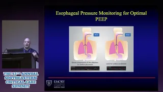 Esophageal Pressure Monitoring for Optimal PEEP - Joe Hylton, MA