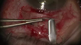 Training in LIVE SURGERY # 2