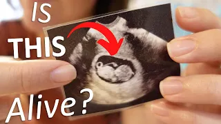 Science Explains Using The 7 Characteristics of Life (Is a Fetus Alive?) - Week 1