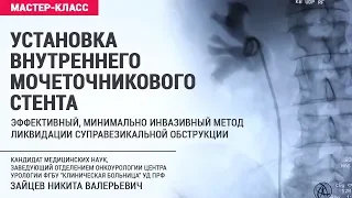 Установка внутреннего мочеточникового стента